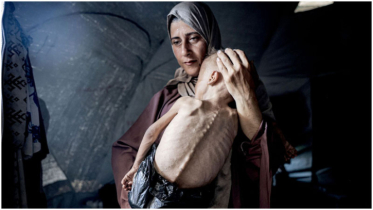 Gaza facing ‘man-made’ mass starvation due to Israeli blockade, WHO