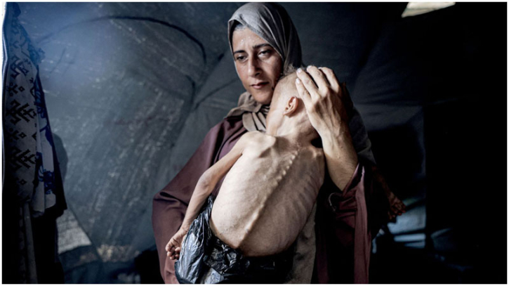 Gaza facing ‘man-made' mass starvation due to Israeli blockade, WHO Gaza facing ‘man-made' mass starvation due to Israeli blockade, WHO