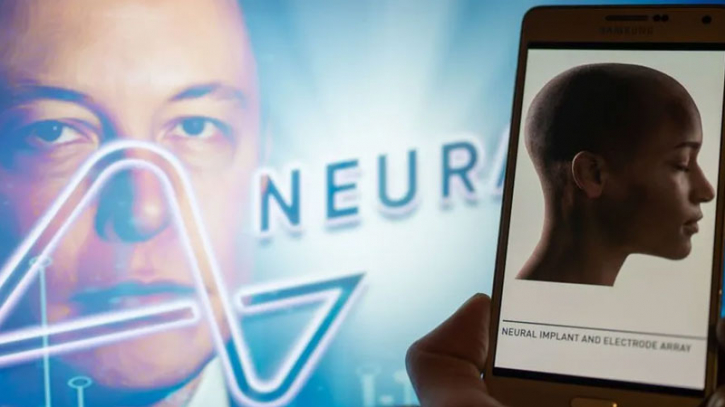 Elon Musk announces 1st wireless brain chip implant